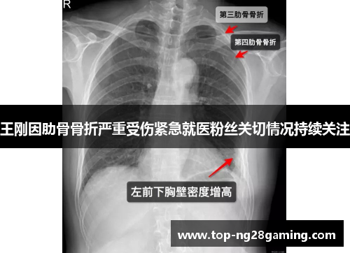 王刚因肋骨骨折严重受伤紧急就医粉丝关切情况持续关注 王刚因肋骨骨折严重受伤紧急就医粉丝关切情况持续关注